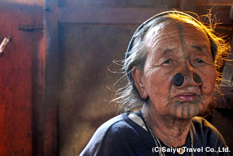 ノーズプラグ(鼻栓)をしたアパタニ族の女性